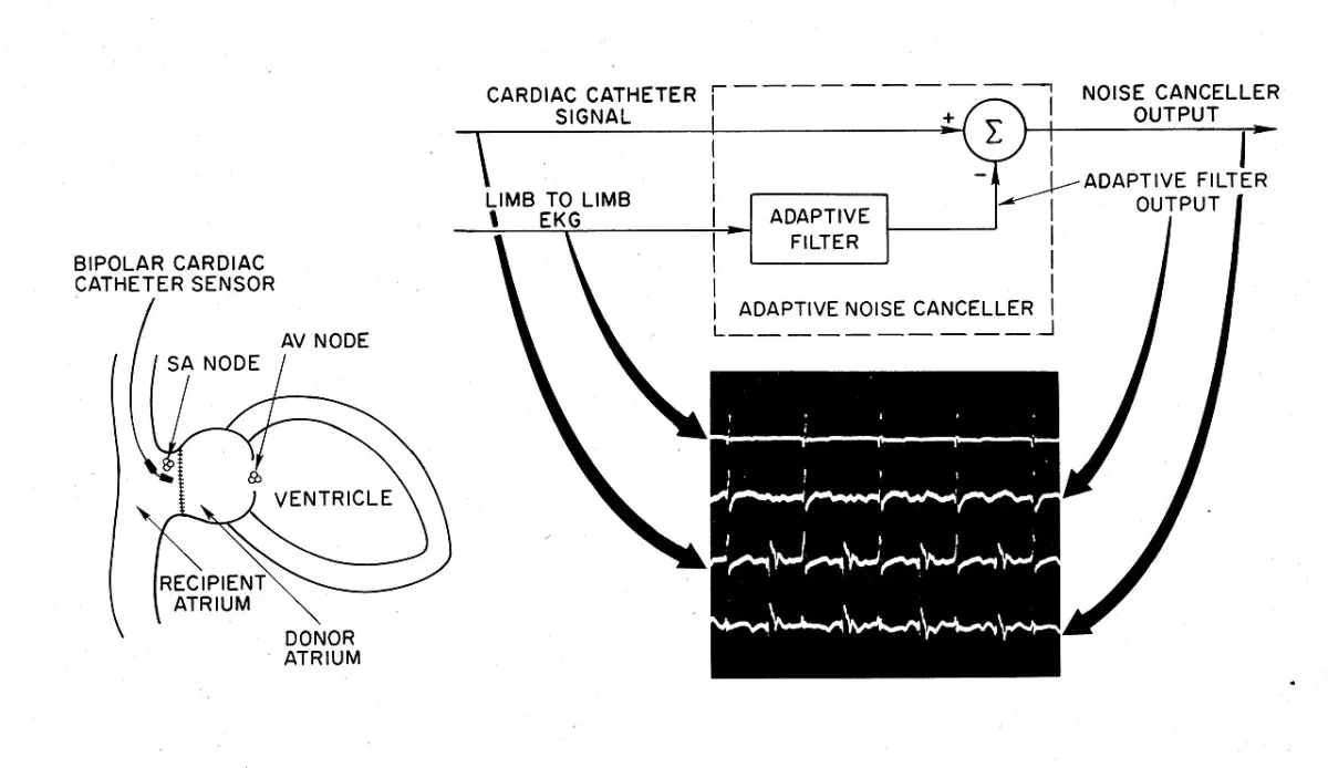 Heart Disease Prediction project