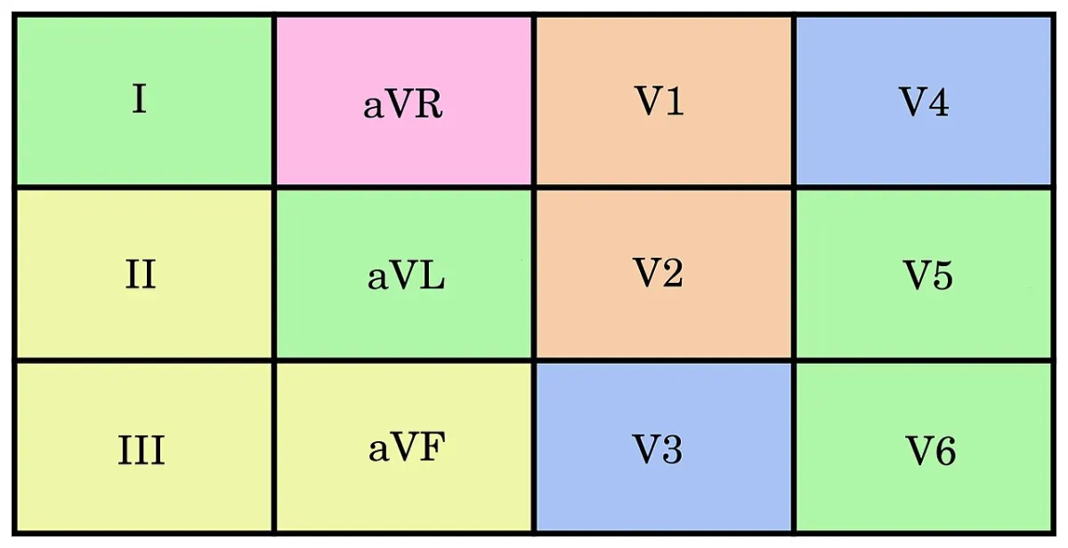 Heart Disease Prediction - ECG Segments Corresponding to Anatomical Structures of the Heart